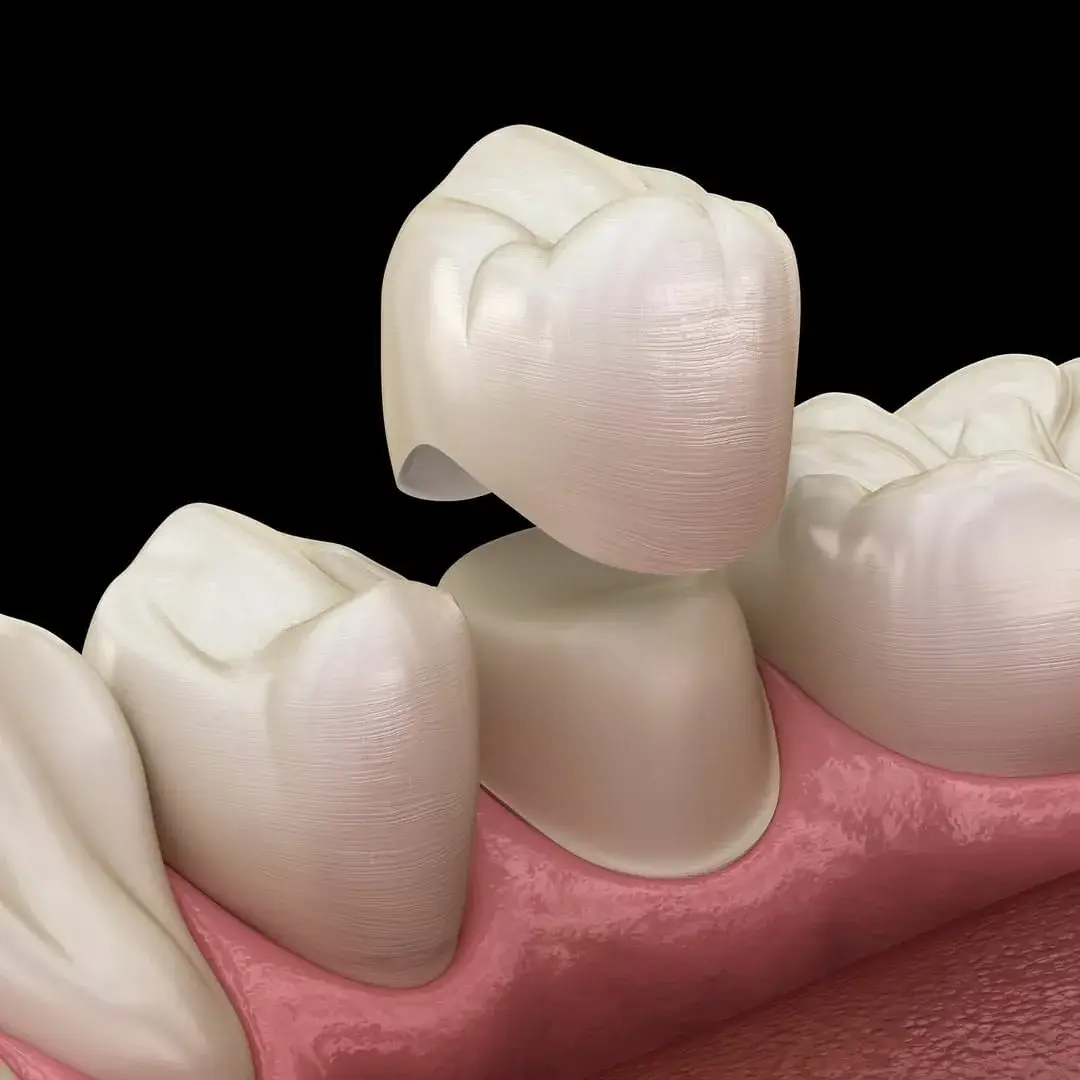 Dentistas em Bauru, Esteticista, Dra Bruna Camilli Odontologia Estética em Bauru, dentistas em Bauru, saúde estética em Bauru, clinica odonto