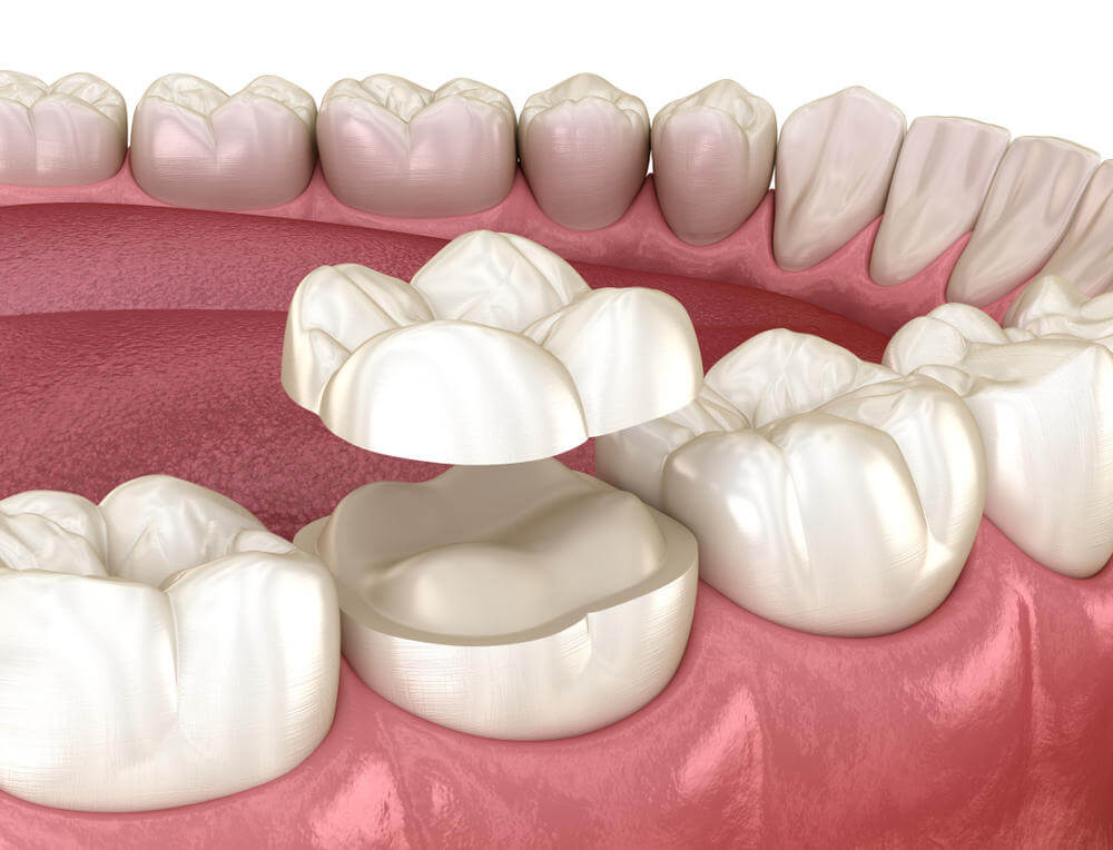 Dentistas em Bauru, Esteticista, Dra Bruna Camilli Odontologia Estética em Bauru, dentistas em Bauru, saúde estética em Bauru, clinica odonto