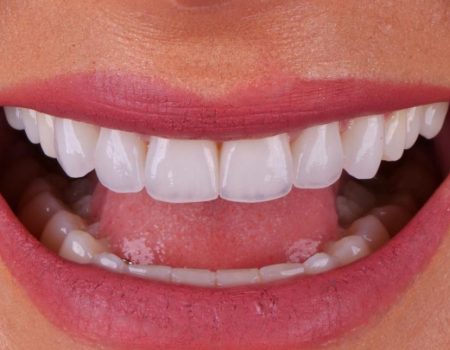 Dr Bruna Camilli | Odontologia e Esteticista em Bauru